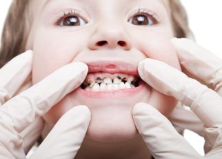 Spot Gum Conditions in Your Child’s Teeth